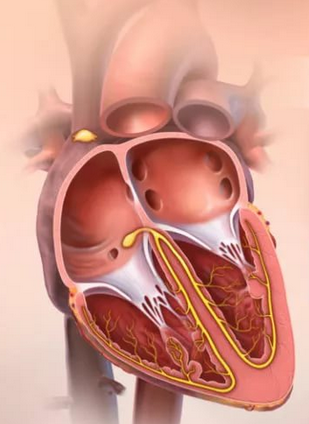  Аритмия сердца. Симптомы и лечение
